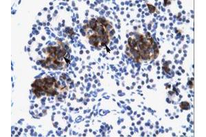 Image no. 1 for anti-Zinc Finger Protein 182 (ZNF182) (AA 543-592) antibody (ABIN6735968) (ZNF182 antibody  (AA 543-592))