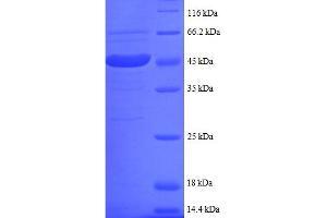 SDS-PAGE (SDS) image for Ubiquitin-Conjugating Enzyme E2I (UBE2I) (AA 1-157), (partial) protein (GST tag) (ABIN5712061)