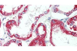 Immunohistochemistry of paraffin-embedded Human Kidney using HSD17B8 Polyclonal Antibody at dilution of 1:100. (HSD17B8 antibody)