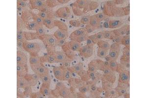 IHC-P analysis of Human Tissue, with DAB staining. (SMOX antibody  (AA 1-165))