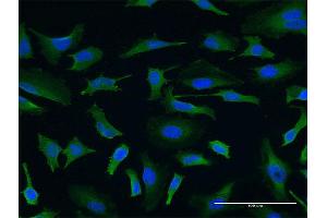 Immunofluorescence of monoclonal antibody to USP9X on HeLa cell. (USP9X antibody  (AA 1-90))