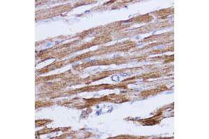 Immunohistochemistry of paraffin-embedded rat heart using NDUFB7 antibody (ABIN6132403, ABIN6144480, ABIN6144481 and ABIN6217781) at dilution of 1:100 (40x lens).