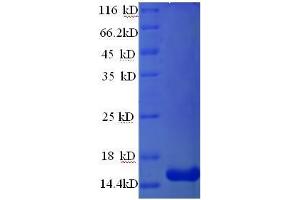 Resistin (RETN) (AA 19-109) protein (His tag) expressed in E. (Resistin Protein (RETN) (AA 19-109) (His tag))