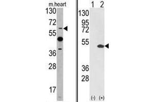 Image no. 3 for anti-Ets Variant 4 (ETV4) (AA 426-455), (C-Term) antibody (ABIN452983) (ETV4 antibody  (C-Term))