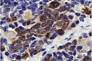 Immunohistochemistry analysis of paraffin-embedded mouse spleen using,NK-p44 (ABIN7074778) at dilution of 1: 500 (NKp44/NCR2 antibody)
