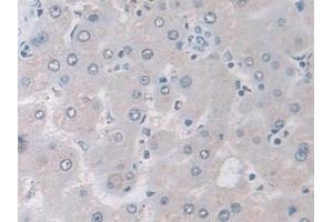 Immunohistochemistry (IHC) image for anti-Isocitrate Dehydrogenase 2 (NADP+), Mitochondrial (IDH2) (AA 40-452) antibody (ABIN7441520)