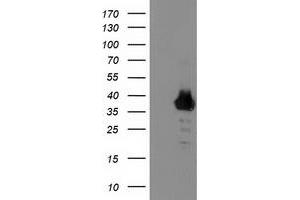 HEK293T cells were transfected with the pCMV6-ENTRY control (Left lane) or pCMV6-ENTRY ZNF397 (Right lane) cDNA for 48 hrs and lysed. (ZNF397 antibody)