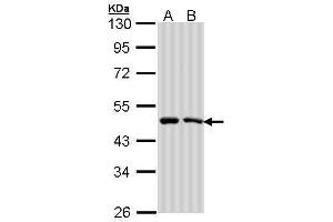 WB Image Sample (30 ug of whole cell lysate) A: A431 , B: H1299 10% SDS PAGE antibody diluted at 1:1000 (SIL1 antibody  (C-Term))