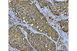 IHC analysis of TMC7 using anti-TMC7 antibody (ABIN7602499). (TMC7 antibody  (AA 8-723))