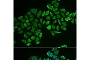Immunofluorescence analysis of MCF-7 cells using RHOD Polyclonal Antibody (RHOD antibody)