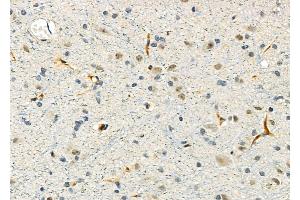 ABIN6260784 and ABIN6276639 at 1/100 staining Rat brain tissue by IHC-P.