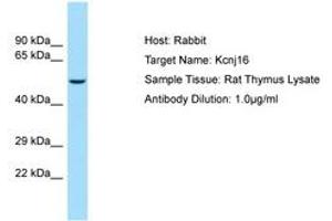 Image no. 1 for anti-Potassium Inwardly-Rectifying Channel, Subfamily J, Member 16 (KCNJ16) (AA 280-329) antibody (ABIN6749836) (KIR5.1 antibody  (AA 280-329))