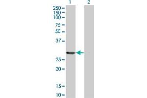 Western Blot analysis of PSME2 expression in transfected 293T cell line by PSME2 monoclonal antibody (M01), clone 3F11-1A3. (PSME2 antibody  (AA 1-239))