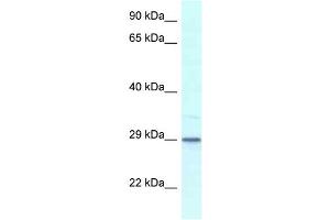 WB Suggested Anti-Kcnip3 Antibody   Titration: 1. (DREAM antibody  (Middle Region))