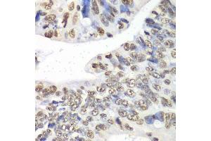 Immunohistochemistry of paraffin-embedded human colon using Nono Antibody. (NONO antibody  (AA 1-300))