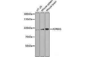 Western blot analysis of extracts of various cell lines using ADRBK1 Polyclonal Antibody at dilution of 1:1000. (GRK2 antibody)