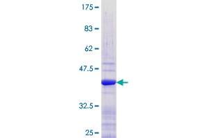 Retinoid X Receptor beta Protein (AA 161-260) (GST tag)