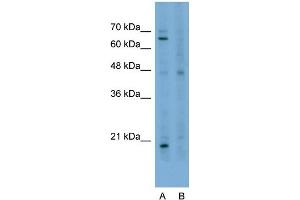 Host:  Rabbit  Target Name:  STAU1  Sample Type:  HepG2  Lane A:  Primary Antibody  Lane B:  Primary Antibody + Blocking Peptide  Primary Antibody Concentration:  2. (STAU1/Staufen antibody  (N-Term))