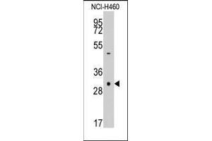 Western blot analysis of anti-CASP3 Pab in NCI-H460 cell line lysates (35ug/lane). (Caspase 3 antibody  (Middle Region))
