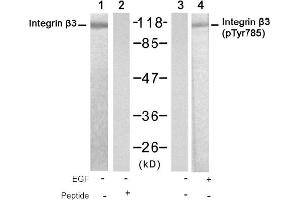 Image no. 1 for anti-Integrin beta 3 (ITGB3) (Tyr785) antibody (ABIN319337) (Integrin beta 3 antibody  (Tyr785))