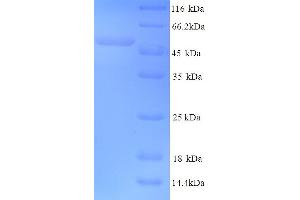 SDS-PAGE (SDS) image for VL2 (AA 1-462), (full length) protein (His tag) (ABIN5714172) (VL2 (AA 1-462), (full length) protein (His tag))