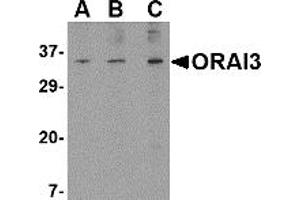 Image no. 1 for anti-ORAI Calcium Release-Activated Calcium Modulator 3 (ORAI3) (N-Term) antibody (ABIN203697) (ORAI3 antibody  (N-Term))