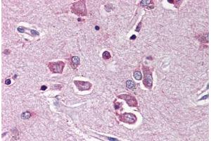 Human Brain, Cortex (formalin-fixed, paraffin-embedded) stained with PTPN11 antibody ABIN214466 at 5 ug/ml followed by biotinylated goat anti-rabbit IgG secondary antibody ABIN481713, alkaline phosphatase-streptavidin and chromogen. (PTPN11 antibody  (N-Term))
