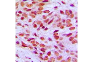 Immunohistochemistry (IHC) image for anti-Friend Leukemia Virus Integration 1 (FLI1) (Center) antibody (ABIN7295680)