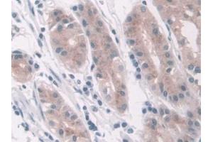 Detection of LDHD in Human Stomach Tissue using Polyclonal Antibody to Lactate Dehydrogenase D (LDHD) (LDHD antibody  (AA 62-265))