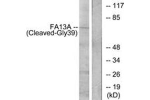 Western blot analysis of extracts from Jurkat cells, treated with etoposide 25uM 24h, using FA13A (Cleaved-Gly39) Antibody. (FA13A (AA 20-69), (Cleaved-Gly39) antibody)