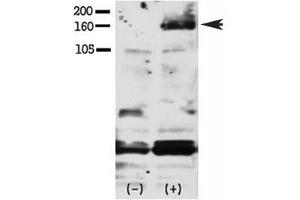 Western blot testing of phospho-HER4 antibody and FG pancreatic carcinoma cells treated with or without EGF (50ng/ml) for 15 min. (ERBB4 antibody  (pTyr1188))
