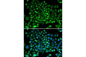 Immunofluorescence analysis of HeLa cells using DNM1L antibody. (Dynamin 1-Like antibody)