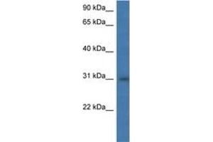 Image no. 1 for anti-Major Histocompatibility Complex, Class II, DM alpha (HLA-DMA) (AA 58-107) antibody (ABIN6746965) (HLA-DMA antibody  (AA 58-107))