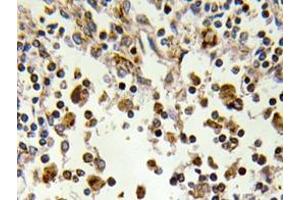 Immunohistochemistry analyzes of MSK1 antibody in paraffin-embedded human lymph node tissue. (MSK1 antibody)