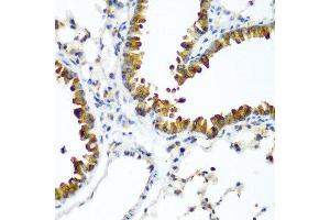 Immunohistochemistry of paraffin-embedded mouse lung using WWTR1 antibody at dilution of 1:200 (40x lens).