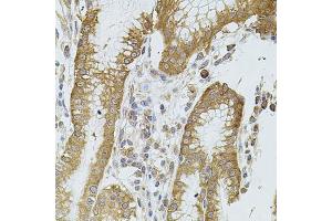 Immunohistochemistry of paraffin-embedded human stomach using CYBB antibody. (CYBB antibody)