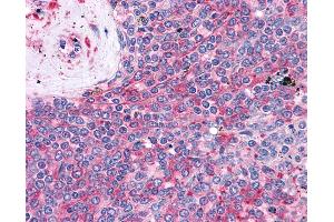 Anti-LST1 antibody IHC of human spleen. (LST1 antibody)