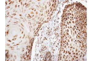 IHC-P Image Immunohistochemical analysis of paraffin-embedded BCC3 xenograft, using COX6B1, antibody at 1:100 dilution. (COX6B1 antibody  (C-Term))