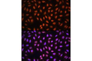Immunofluorescence analysis of U-2 OS cells using MCM5 Rabbit pAb (ABIN6132074, ABIN6143644, ABIN6143646 and ABIN6217542) at dilution of 1:100 (40x lens). (MCM5 antibody  (AA 1-230))