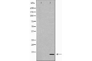 Western blot analysis of extracts of Recombinant protein, using NRG4 antibody. (Neuregulin 4 antibody  (C-Term))