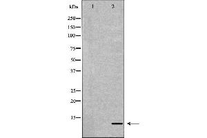 Western blot analysis of Mouse liver tissue lysates, using APOC2 Antibody. (Apolipoprotein C-II antibody  (Internal Region))