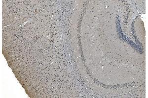 IHC analysis of LSM7 using anti-LSM7 antibody (ABIN7598937). (LSM7 antibody  (AA 1-103))