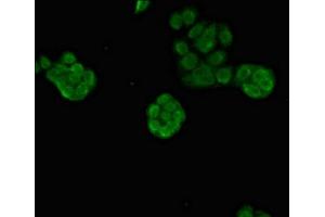 Immunofluorescent analysis of PC-3 cells using ABIN7164089 at dilution of 1:100 and Alexa Fluor 488-congugated AffiniPure Goat Anti-Rabbit IgG(H+L) (PRDM16 antibody  (AA 448-683))