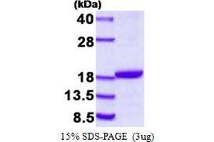 Destrin (Actin Depolymerizing Factor) (DSTN) protein (His tag)