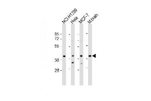 All lanes : Anti-TWF1 Antibody (Center) at 1:2000 dilution Lane 1: NCI- whole cell lysate Lane 2: Hela whole cell lysate Lane 3: MCF-7 whole cell lysate Lane 4: mouse brain lysate Lysates/proteins at 20 μg per lane. (TWF1 antibody  (AA 201-235))