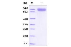 Mouse ROR1, Fc Tag on SDS-PAGE under reducing (R) condition. (ROR1 Protein (AA 30-403) (Fc Tag))