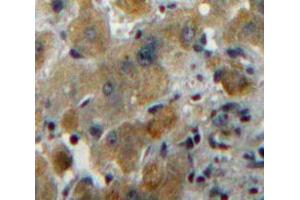 Used in DAB staining on fromalin fixed paraffin-embedded Liver tissue (MUC6 antibody  (AA 2338-2439))