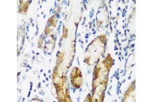 Immunohistochemistry of paraffin-embedded Human gastric using NAA60 Polyclonal Antibody at dilution of 1:200 (40x lens). (NAT15 antibody)