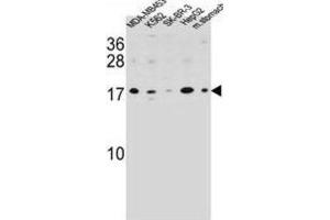 Western Blotting (WB) image for anti-S100 Calcium Binding Protein Z (S100Z) antibody (ABIN2995739)