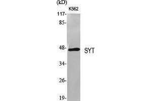 Western Blot (WB) analysis of specific cells using SYT Polyclonal Antibody. (SS18 antibody  (N-Term))